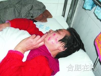 ·公交司機咬傷六旬老乘客