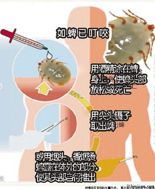 菜地干活后高燒不退八旬翁被蜱蟲(chóng)叮咬致死