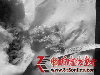 　　▲圖為包子中吃出的塑料袋(陳女士提供)。