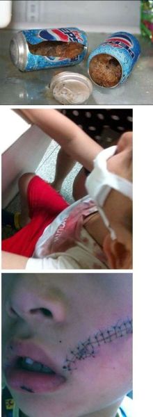 上海嘉定一男孩從冰箱冷凍室拿出一聽(tīng)百事可樂(lè),開(kāi)啟瞬間突然發(fā)生爆炸。圖片來(lái)源:消費(fèi)者微博